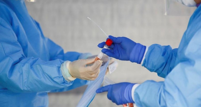 Brasil acumula 867,6 mil casos do novo coronavírus