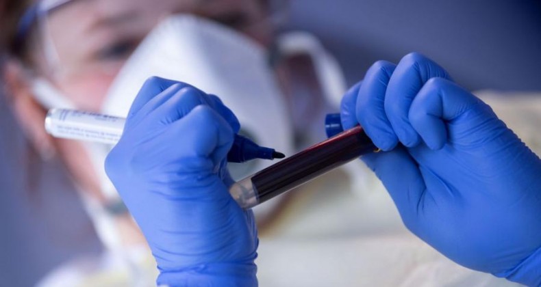 Covid-19: Brasil registra mais 10,5 mil casos confirmados em 24h