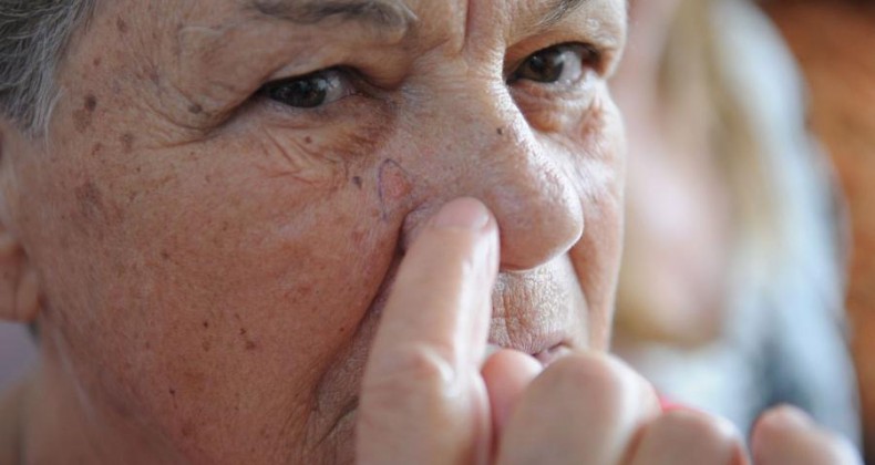 Câncer de pele é tema da campanha Dezembro Laranja