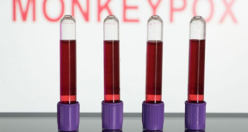 Anvisa autoriza uso emergencial de kits para varíola dos macacos