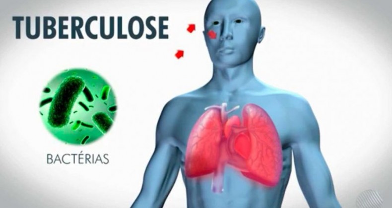 Estudo revela compostos que podem combater um tipo de tuberculose