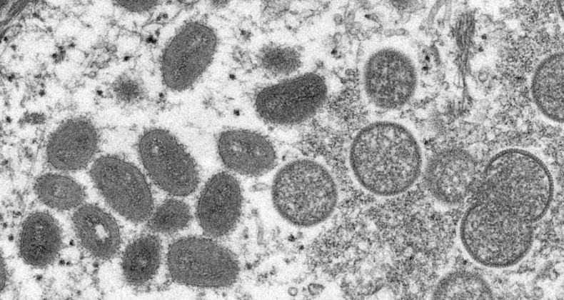 Saúde monitora sete casos suspeitos de varíola dos macacos